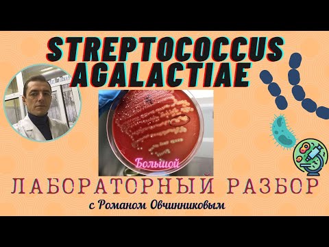 Видео: Стретококки группы В (Streptococcus agalactiae) - большой лабораторный разбор с Романом Овчинниковым