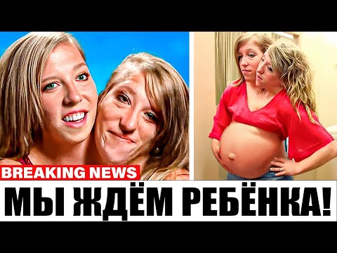 Видео: Правда о беременности Абби и Бреттани