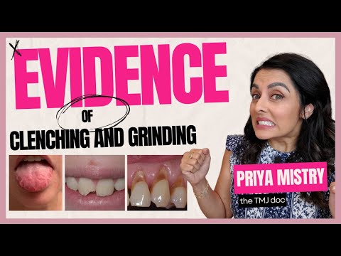 Видео: Физические признаки стискивания и скрежетания зубами/бруксизма — Прия Мистри, доктор стоматологии...