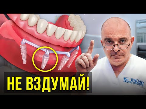 Видео: НИКОГДА не устанавливай ТАКИЕ протезы! ГЛАВНАЯ ошибка большинства..