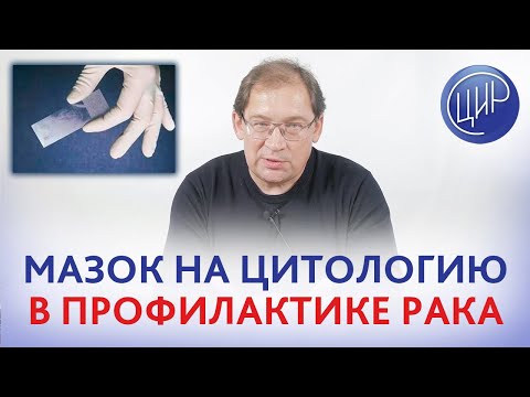 Видео: Мазок на цитологию в профилактике рака шейки матки. Рассказывает доктор Гузов.