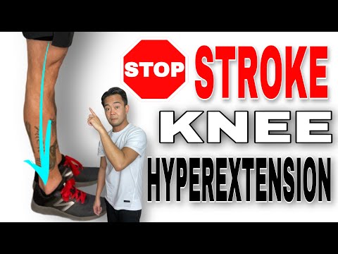 Видео: Как исправить переразгибание колена после инсульта