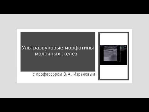 Видео: Ультразвуковые морфотипы молочных желез