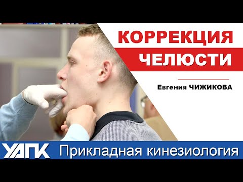 Видео: Коррекция шва верхней челюсти (Е.Чижикова)