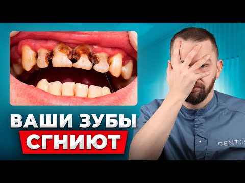 Видео: Вот из-за чего могут сгнить зубы. Врачи скрывают это