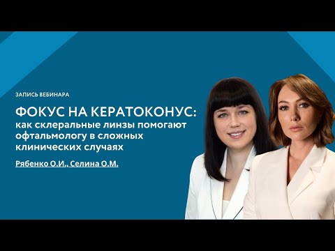 Видео: Фокус на кератоконус: как склеральные линзы помогают офтальмологу в сложных клинических случаях