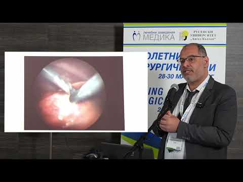 Видео: 39. Противоречия и актуализации в управлението на хидатидната болест при деца, Controversies ...