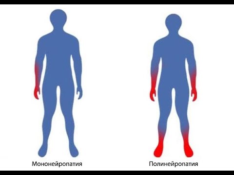 Видео: ТВ. Полинейропатия. Polyneuropathy