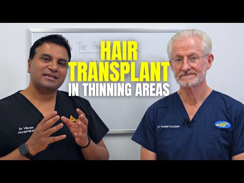 Видео: Управление пересадкой волос в зонах истончения