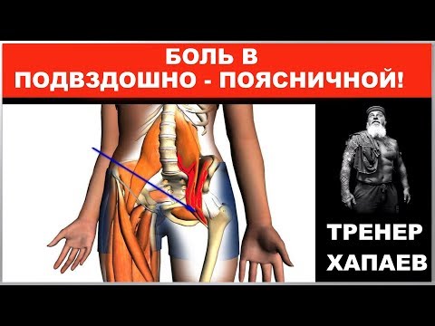 Видео: Боль в подвздошной при КОКСАРТРОЗе! Разбираемся, что и почему? / ТРЕНЕР ХАПАЕВ