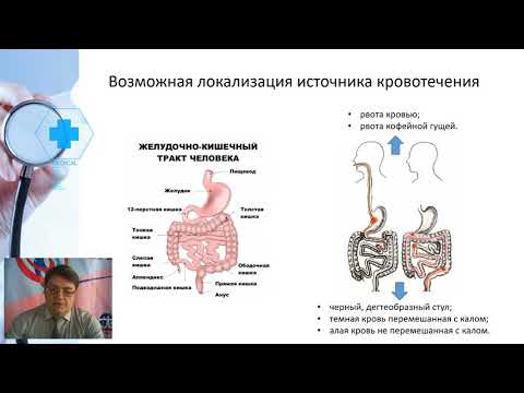 Видео: Желудочно кишечные кровотечения Тактика больного