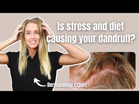 Видео: Основная причина себорейного дерматита и способы его естественного лечения