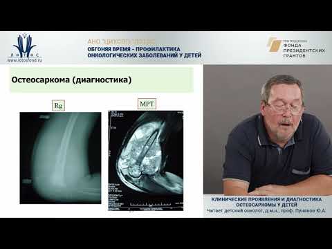 Видео: Клинические проявления и диагностика остеосаркомы у детей