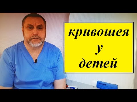 Видео: Кривошея у детей. Почему возникает и способы лечения.