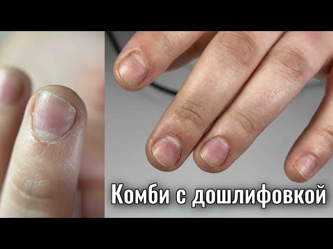 Видео: КОРРЕКЦИЯ НОГТЕЙ. Виктория Авдеева