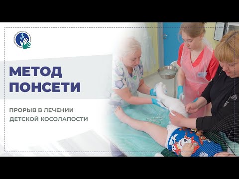 Видео: Метод Понсети: прорыв в лечении детской косолапости