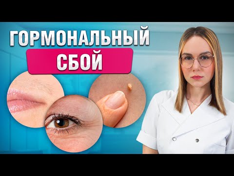 Видео: Первые симптомы проблем! Почему происходит гормональный сбой?