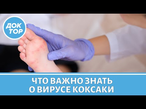 Видео: Насколько опасен вирус Коксаки | Как провести отпуск без последствий