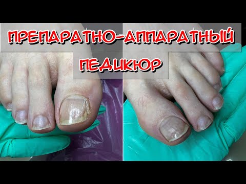 Видео: Препаратно-аппаратный педикюр / Средства для педикюра / Фрезы для педикюра
