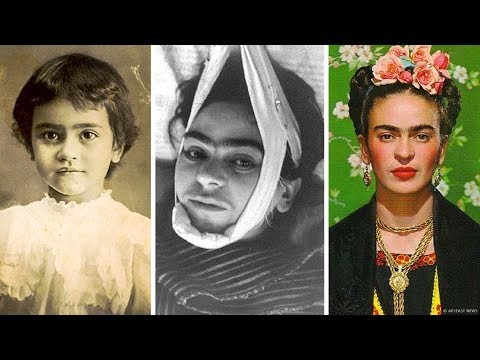 Видео: Трагическая история Фриды Кало