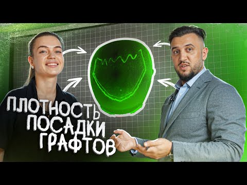 Видео: Плотность графтов: главный секрет успешной пересадки волос