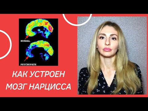 Видео: 🔺Как устроен мозг Нарцисса🔻