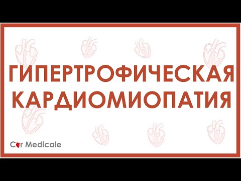 Видео: Гипертрофическая кардиомиопатия - причины, механизмы, симптомы, последствия
