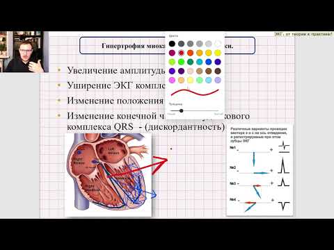 Видео: Введение в патологию ЭКГ. Гипертрофии миокарда - ГЛЖ, ГПЖ, ГПП, ГЛП.