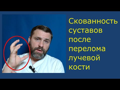 Видео: Скованность суставов после перелома лучевой кости. Причины и как себе помочь.