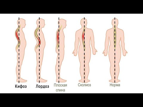 Видео: Вебинар по выравниванию спины 2021