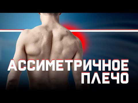 Видео: Асимметричное или опущенное плечо?