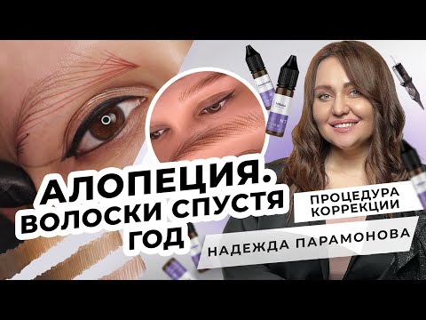 Видео: Алопеция. Волоски спустя год. Процедура коррекции | Мастер PMU Надежда Парамонова
