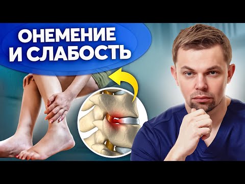 Видео: НОГИ ОТКАЖУТ! Симптомы стеноза позвоночного канала
