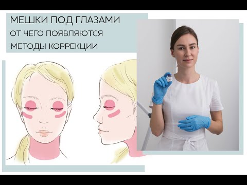 Видео: Все про малярные мешки с Марией Носулич: физиология, причины, коррекция