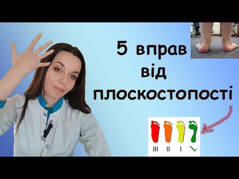 Видео: Поздовжня  плоскостопість вправи для дітей і дорослих щоб запобігти плоскостопості і лікувати наявну