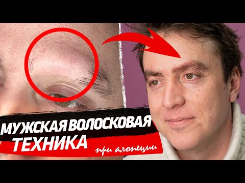 Видео: Мужская волосковая техника при алопеции – Восстановление брови - Часть 2. Форма бровей мужчин