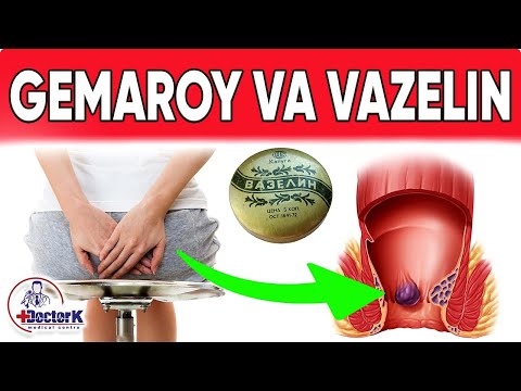 Видео: ДАХШАТ!! ГЕМАРОЙ БИР ЗУМДА ЙЎҚ БЎЛДИ! ОДДИЙ ВАЗЕЛИН ВА ....