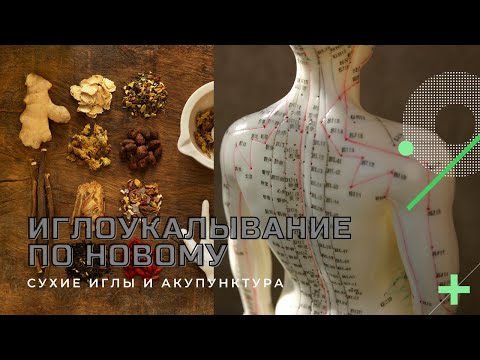 Видео: Фасции и синовиальные сумки в иглоукалывании. Акупунктура и сухие иглы