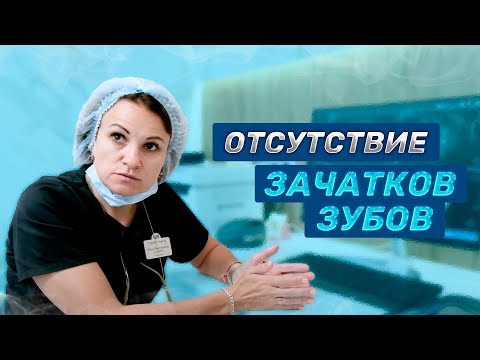 Видео: У ребёнка нет зачатков коренных зубов | Советы врача-стоматолога| Студия улыбок. Стоматология Сочи.