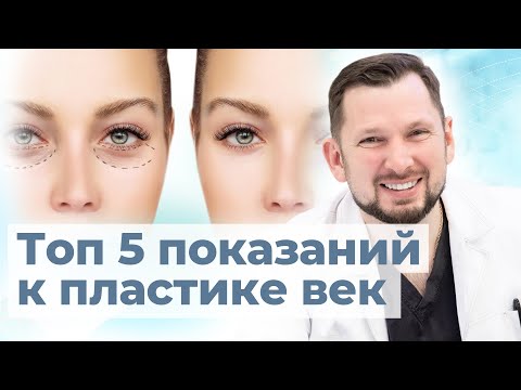Видео: Когда нужна блефаропластика? | Показания к пластике век | Пластический хирург о блефаропластике век
