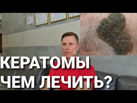 Видео: Кератомы. Чем лечить?