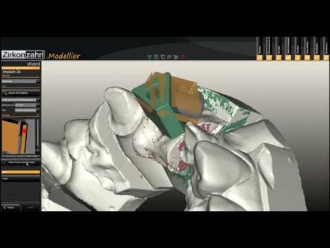 Видео: АртМинЛаб - Моделирование абатмена.