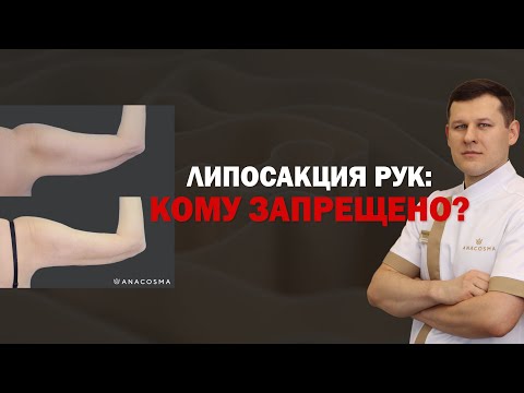 Видео: ЛИПОСАКЦИЯ РУК: КОМУ ЗАПРЕЩЕНО❗🔥 ДО ПОСЛЕ