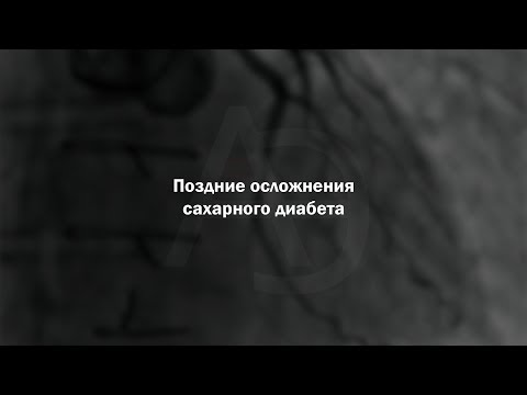 Видео: Поздние осложнения сахарного диабета