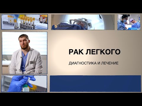 Видео: Рак легкого. Методы лечения.