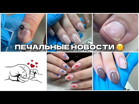 Видео: Печальные события☹️ОНИХОЛИЗИС 2.0🤞🏼много работы🫶ВЛОГИ Nailbloggera❤️НИТРИЛОВЫЕ перчатки с WB💜