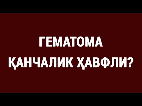 Видео: Гематома қанчалик ҳавфли? | How dangerous is hematoma?