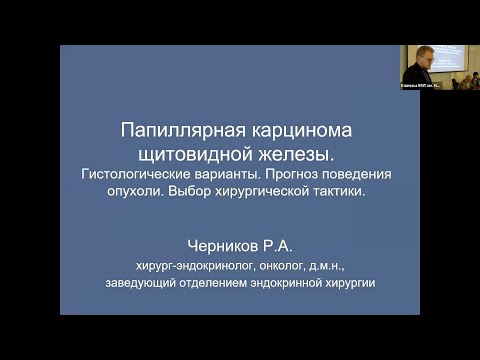 Видео: Папиллярная карцинома.Гистологические варианты.Прогноз поведения опухоли.Выбор хирургической тактики