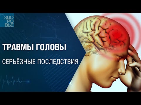 Видео: Травмы головы. Серьёзные последствия. На здоровье 10.09.2022