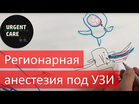 Видео: Регионарная анестезия под УЗИ. ESP